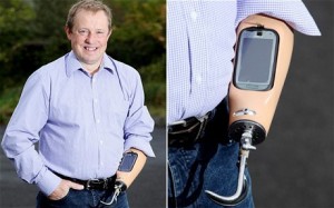 prideaux-prosthetic-arm-duo