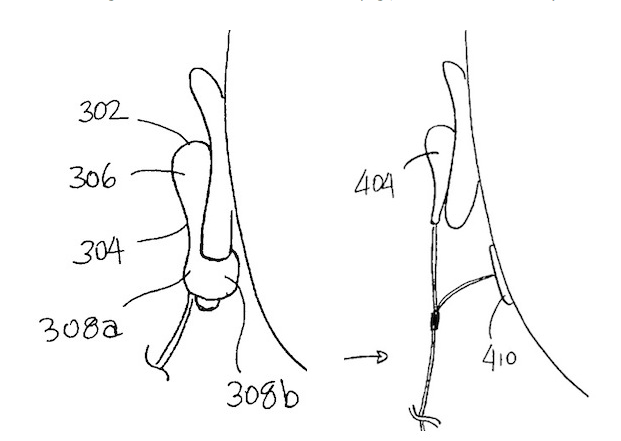 Screen Shot 2557-05-03 at 2.41.21 AM