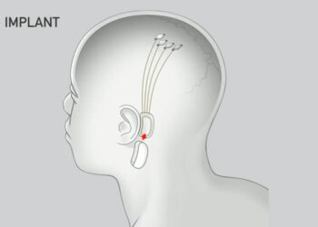 Elon Musk เปิดตัวโครงการเชื่อมต่อคอมพิวเตอร์เข้ากับสมอง วางแผนทดลองกับมนุษย์ในปี 2020