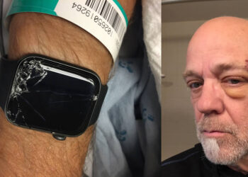 Apple Watch ช่วยให้ทีมแพทย์ฉุกเฉิน ช่วยเหลือนักขี่จักรยานเสือภูเขา หลังจากประสบอุบัติเหตุ