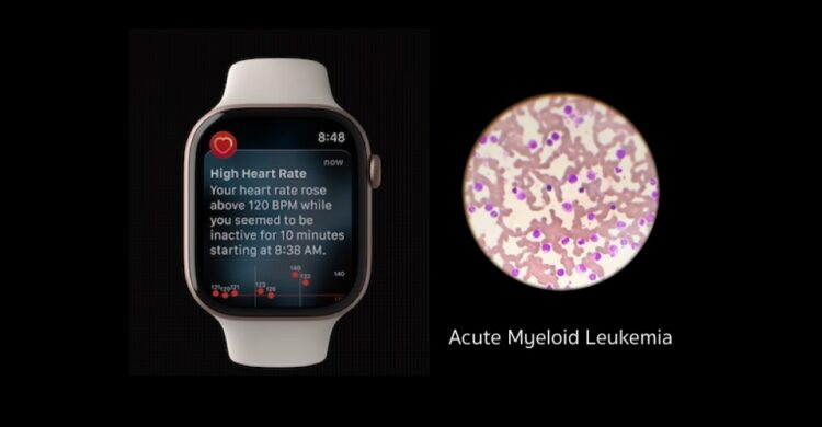 Apple Watch ช่วยให้สาวรายหนึ่ง รอดชีวิตจากมะเร็งเม็ดเลือดขาวชนิดเฉียบพลัน