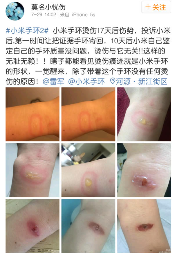 xiaomi-Mi-Band2-effect