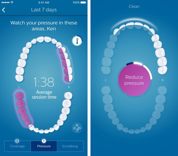 Philips-Sonicare-DiamondClean-Smart-App-2
