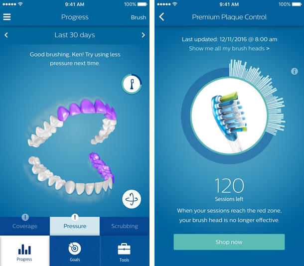 Philips-Sonicare-DiamondClean-Smart-App-3