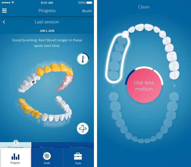 Philips-Sonicare-DiamondClean-Smart-App