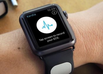 KardiaBand สายนาฬิกา Apple Watch สามารถตรวจหาภาวะโพแทสเซียมในเลือดสูง และหัวใจห้องบนเต้นผิดปกติได้