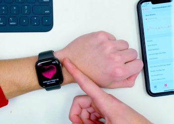 5 สิ่งที่ต้องรู้เกี่ยวกับแอพพลิเคชั่น ECG (Electrocardiogram) บน Apple Watch