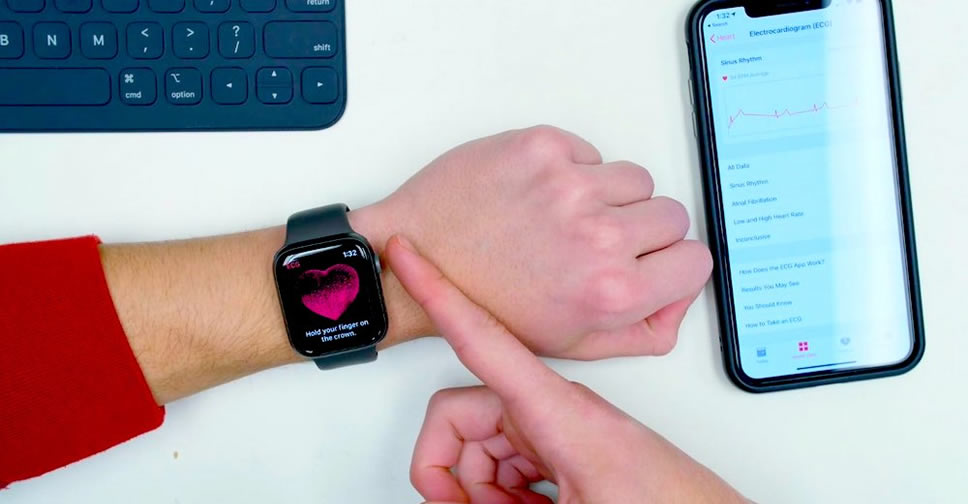 ECG Apple Watch Series 4