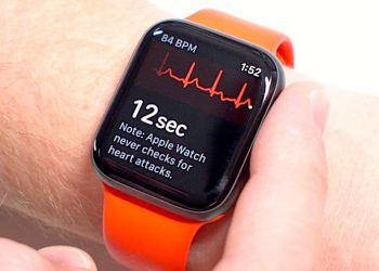 5 สิ่งที่ต้องรู้เกี่ยวกับแอพพลิเคชั่น ECG (Electrocardiogram) บน Apple Watch