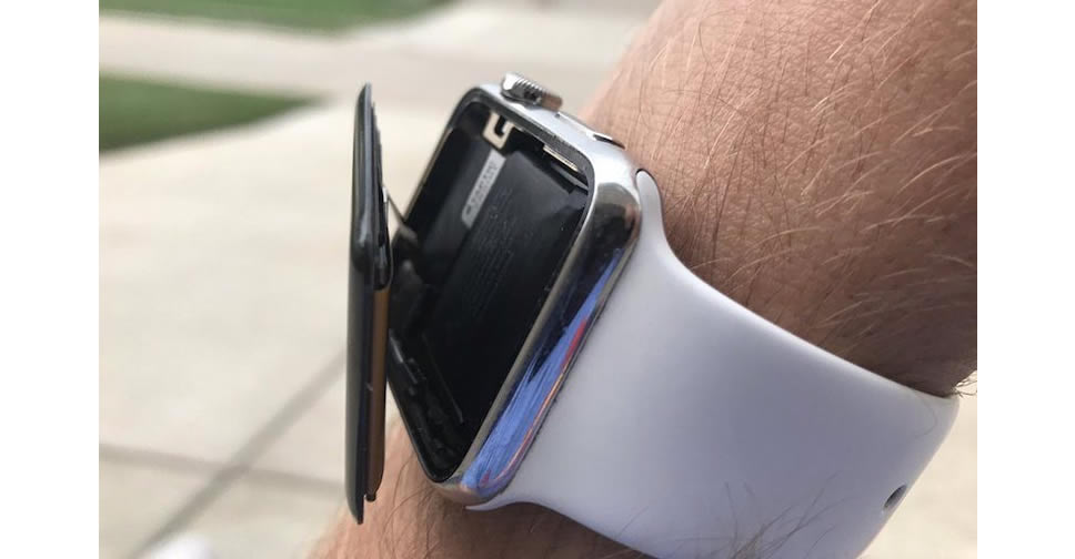 Apple ถูกเจ้าของ Apple Watch ฟ้องร้อง!! เนื่องจากแบตเตอรี่บวม จนทำให้