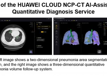 HUAWEI CLOUD เปิดตัวอุปกรณ์ผู้ช่วย AI วิเคราะห์ ‘COVID-19’ ทราบผลแบบ CT Quantification ภายในไม่กี่วินาที